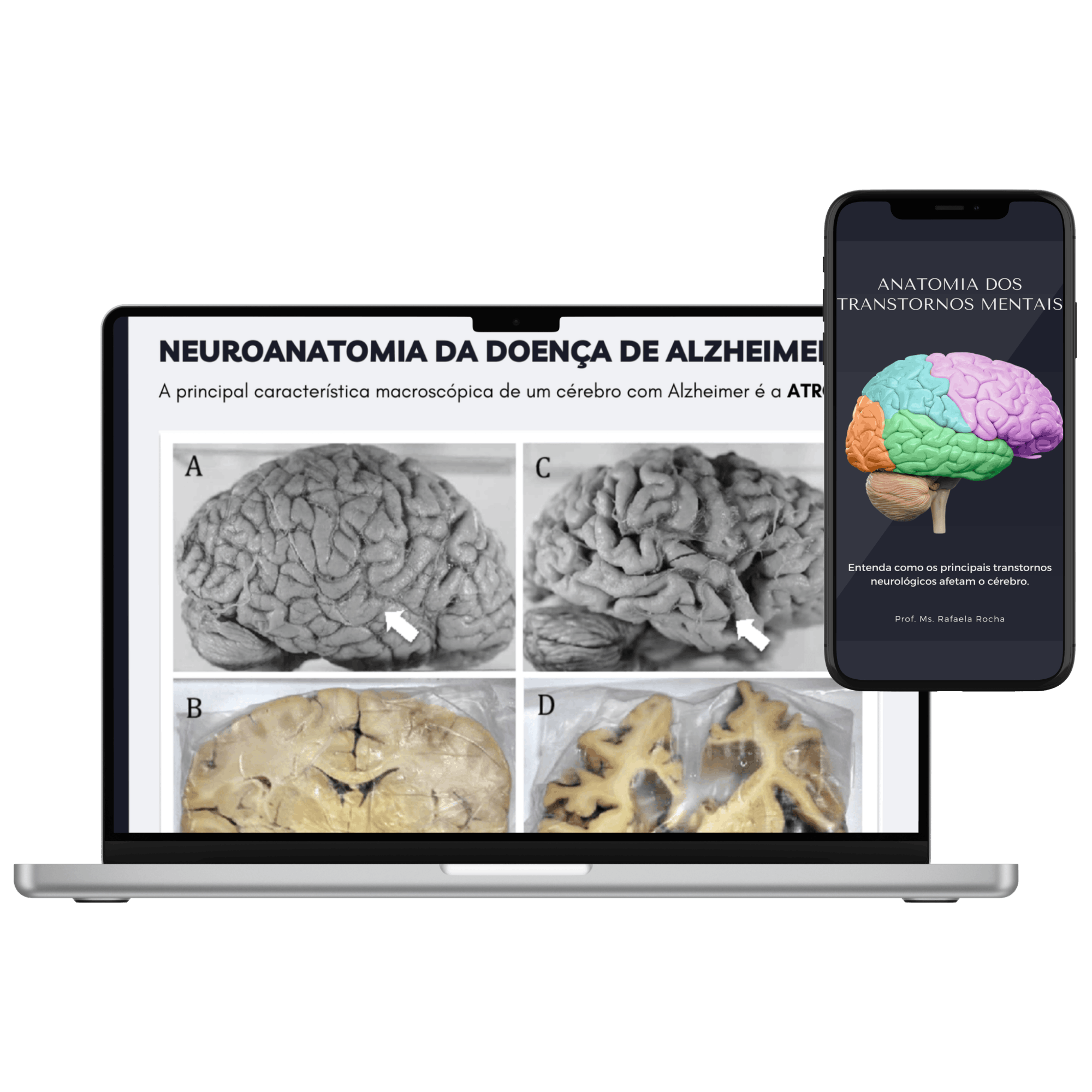 E-book Anatomia dos Transtornos Mentais